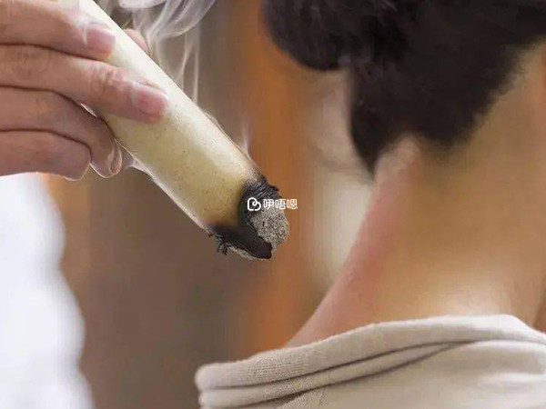 不能艾灸8種人群介紹