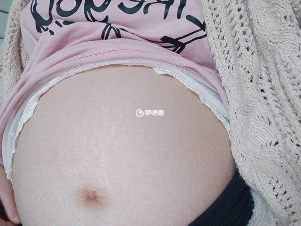 妊娠線又細又直懷男孩
