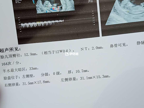 生女兒的nt單子圖片