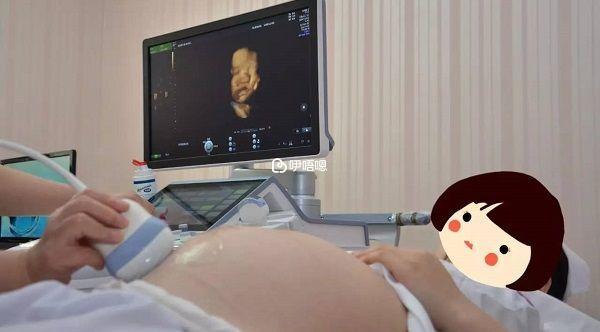 彩超檢查前孕婦也不需要服用任何藥物
