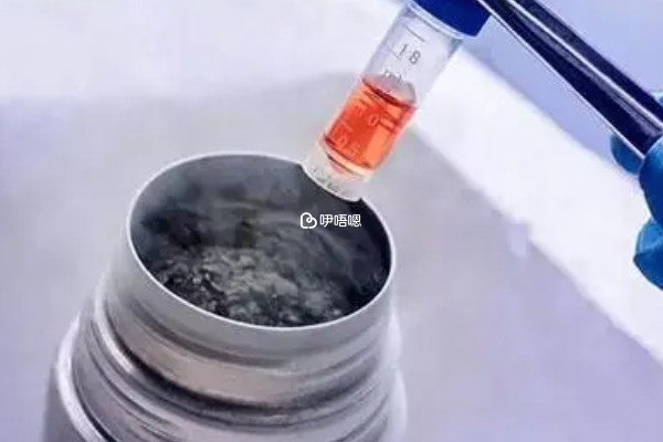 自然週期促排取卵後一般不需要凍卵