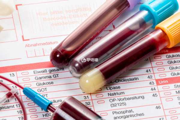 試管前期檢查會查hiv