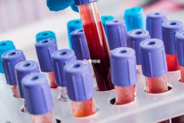 不要輕易去做hpv和tct檢查的原因