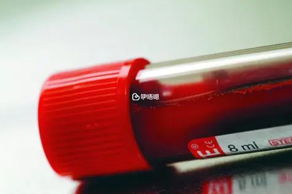 其他疾病會造成梅毒假陽性