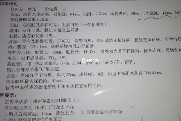 無創DNA有必要做升級版